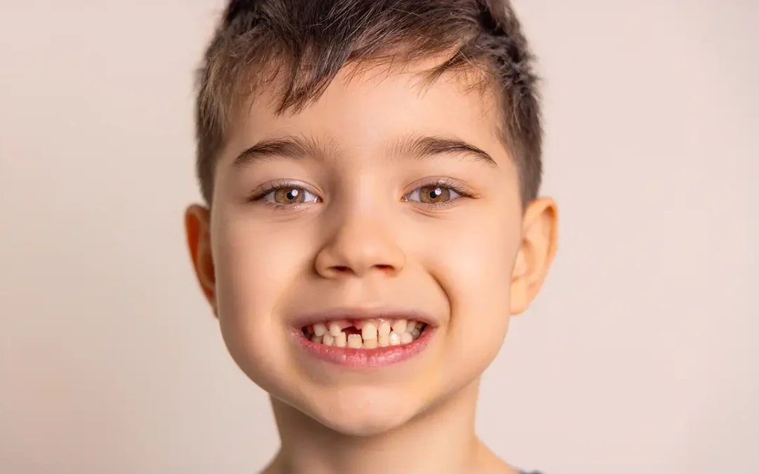 Apparecchio per Bambini a Roma San Giovanni: Quando è il Momento Giusto?