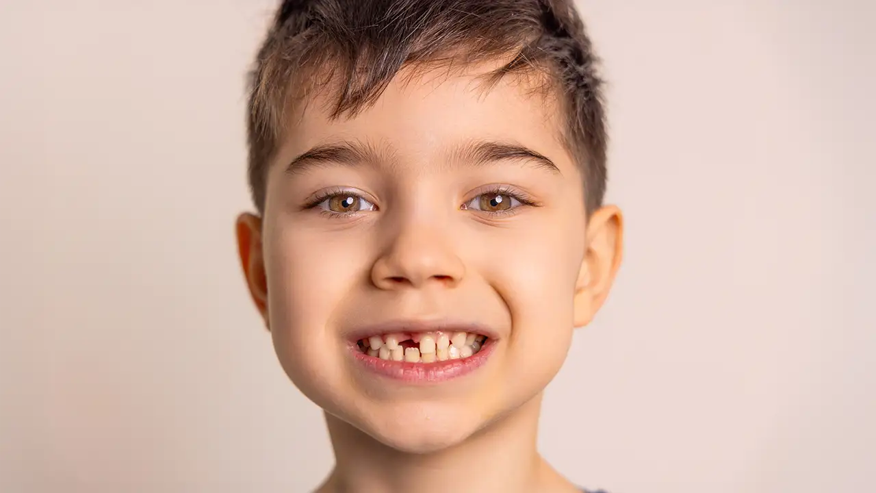 Apparecchio per Bambini a Roma San Giovanni - Quando è il Momento Giusto - Dr. Emanuele Ciulli - Odontoiatria Estetica e Infantile, Roma